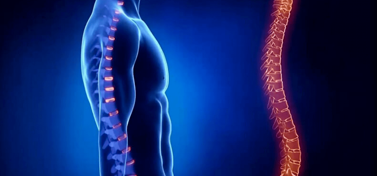 Spinal Läsionen wéinst Osteochondrose