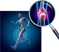 Arthrosis vum Kniegelenk